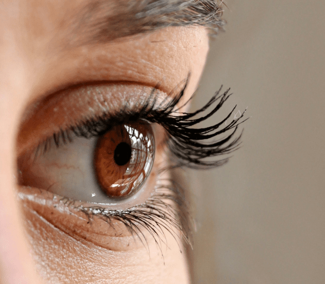 Eyelid Lift