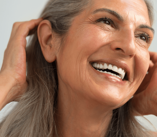  Microneedling